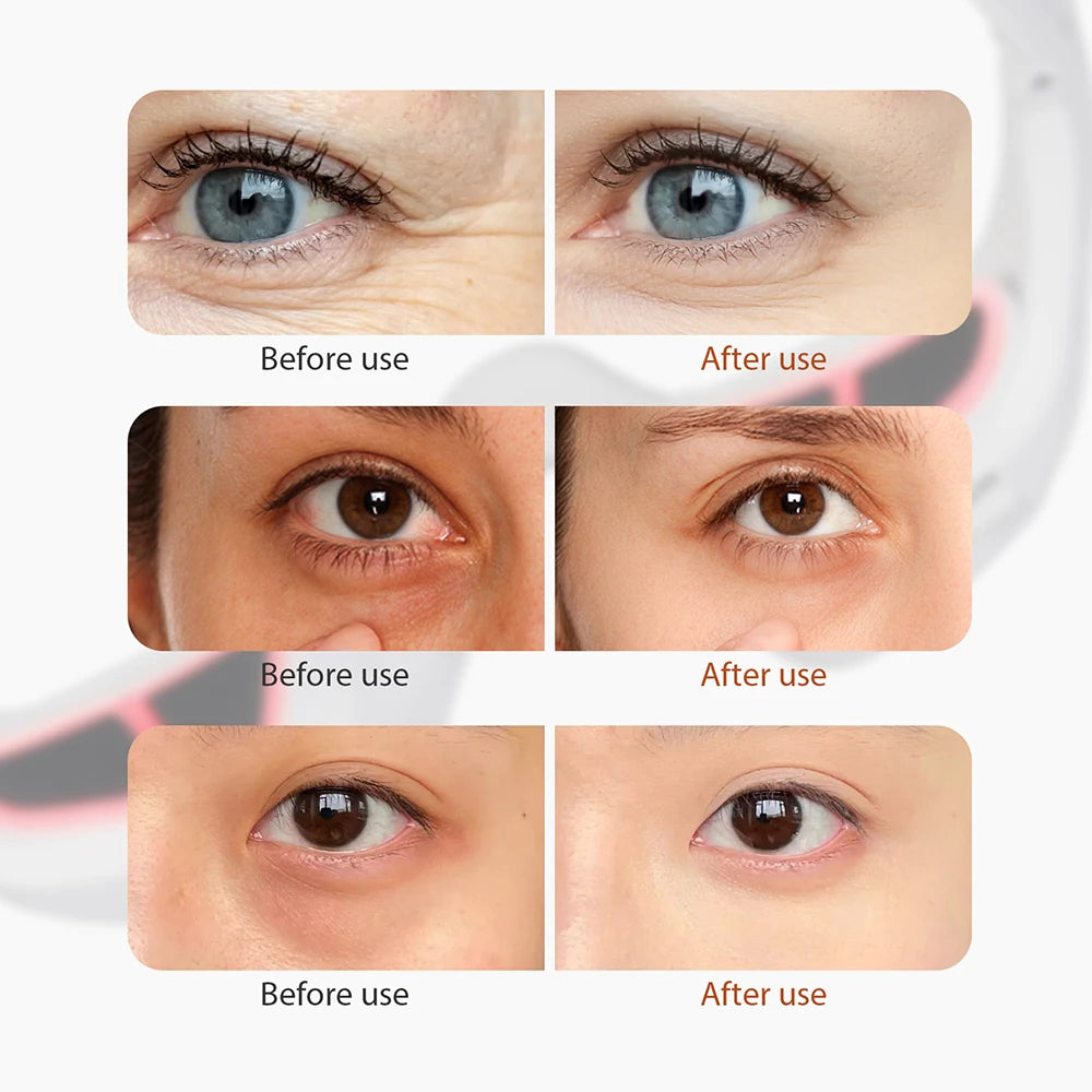 RedBright Eye / Rotlicht Unteraugen-Massagegerät